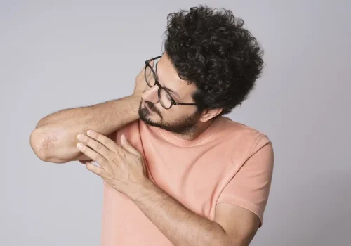 chico mirando el codo con psoriasis