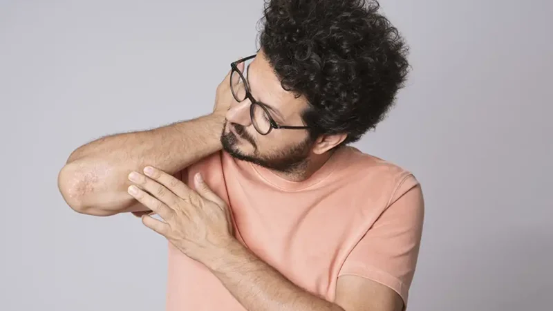 chico mirando el codo con psoriasis