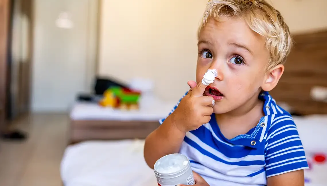 dermatitis atópica. niño con crem ahidratante