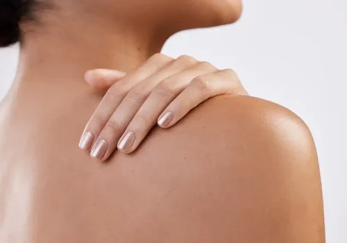 Sistema inmunológico de la piel