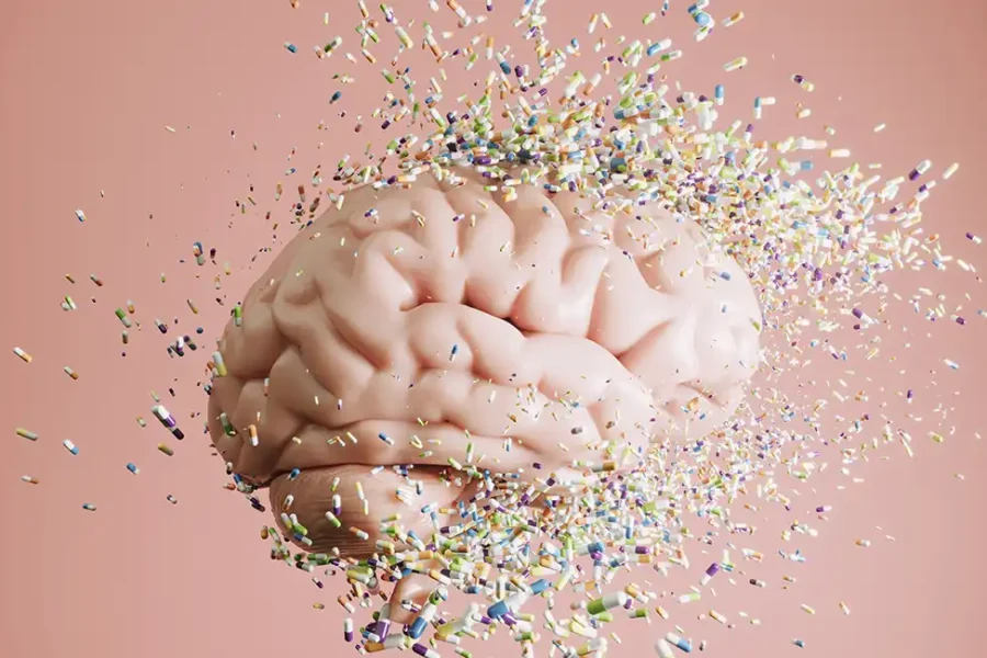 Alzheimer