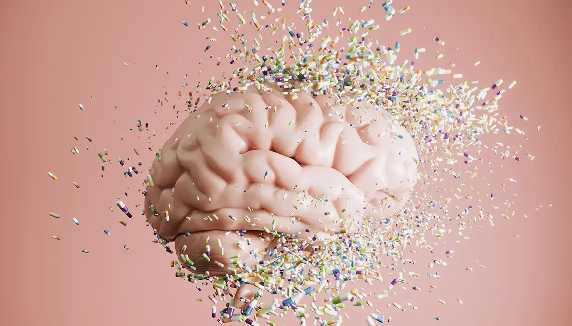 Alzheimer