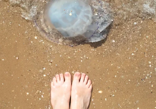 Picadura de medusa