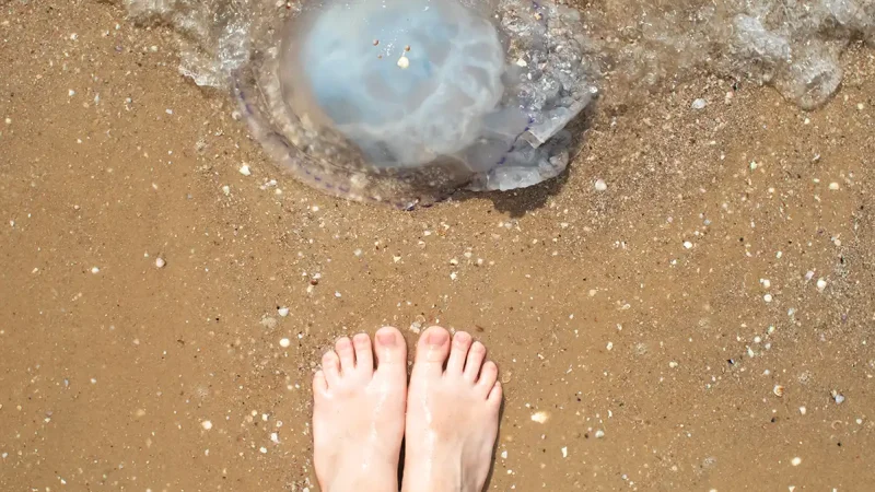 Picadura de medusa