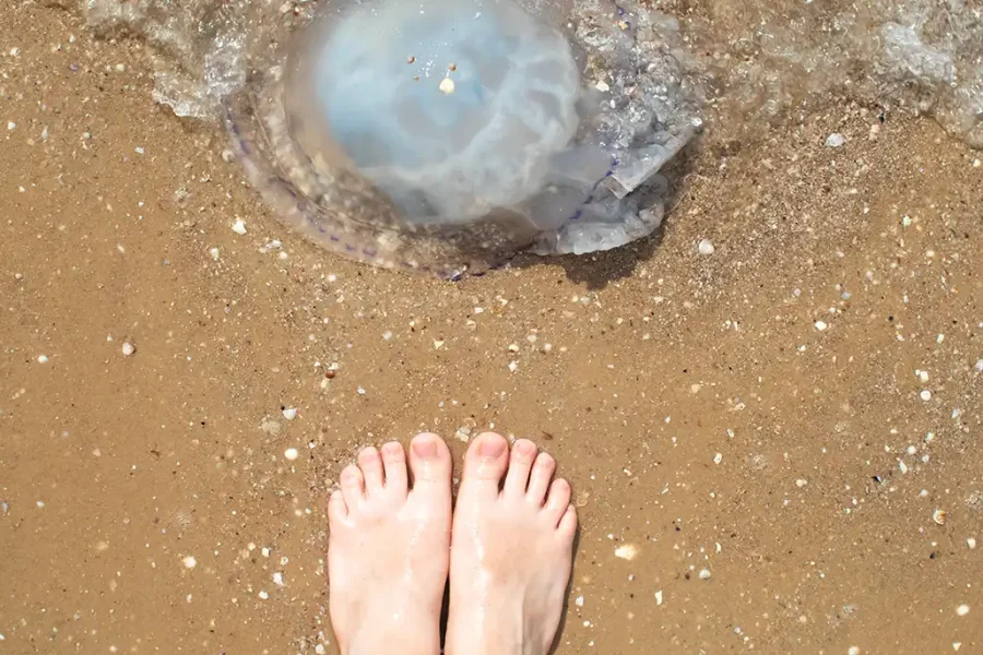 Picadura de medusa
